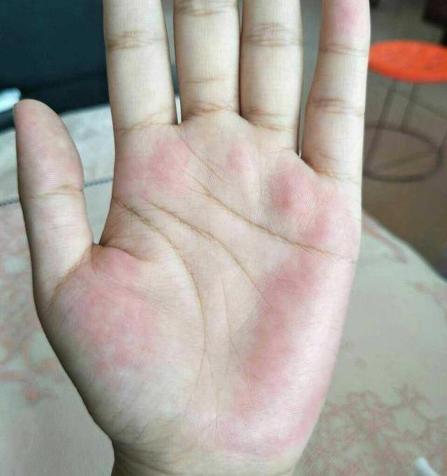 肝掌（可缩小做成圆形图）.png